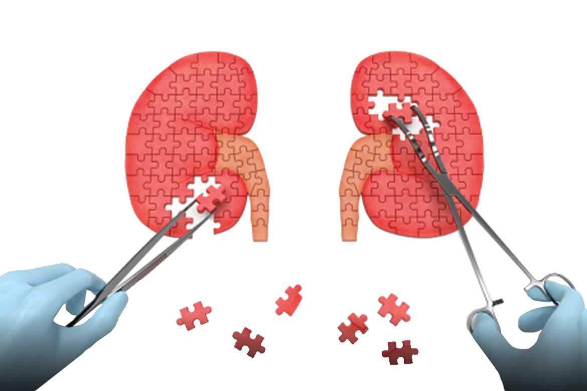 cirugia endoscopica uretral