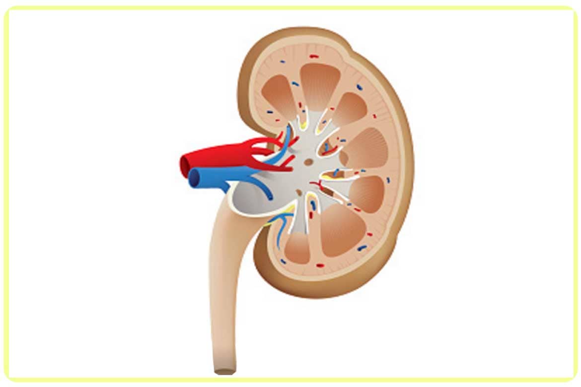 nefrolitricia incorporea